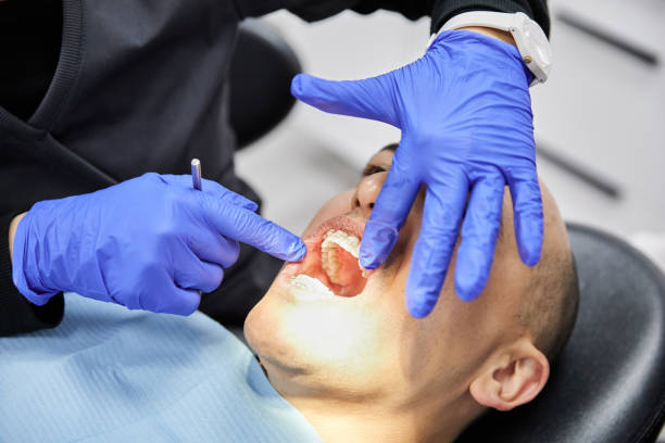 Best Emergency Broken Tooth Repair in Piedmont, AL