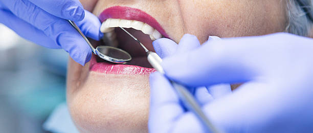 Best Emergency Broken Tooth Repair in Piedmont, AL